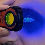 Close-up of an eye illuminated with blue light during a home exam using the Lumio device