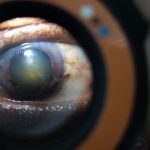 Eye with visible cataract viewed through Lumio diagnostic device