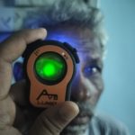Fluorescein dye illumination using Lumio device for corneal surface evaluation.