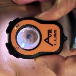 Eye examination using Lumio diagnostic device to assess anterior segment and Iris health.