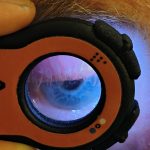 Close-up view through Lumio lens showing an elderly patient’s eye under examination.