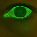 A close-up image of a human eye illuminated with green light, highlighting the contours and details of the iris and pupil