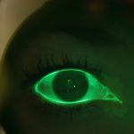 Human eye glowing a fluorescent green colour