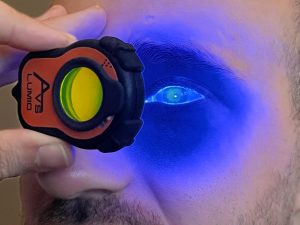 Blue light shone on to patient eye with Lumio device held close