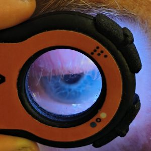 Lumio anterior eye examination on older patient